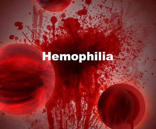 What is hemophilia? What are its symptoms and causes?